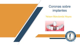 Yeison Marulanda Hoyos
Coronas sobre
implantes
 