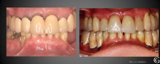 Técn. J.C. Sebático