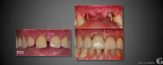 Técn. J.C. Sebático