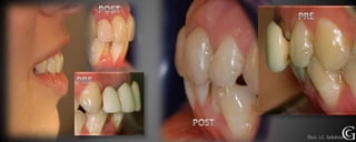 Técn. J.C. Sebático