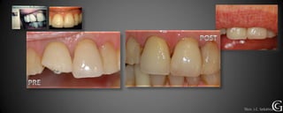 Técn. J.C. Sebático