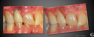 Técn. J.C. Sebático