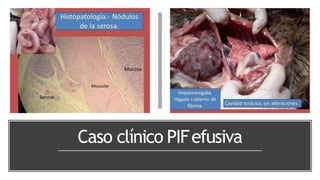 Caso clínico PIFefusiva
 