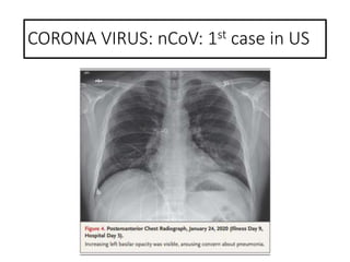CORONA VIRUS: nCoV: 1st case in US
 