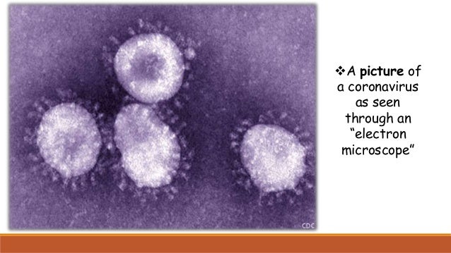 A picture of
a coronavirus
as seen
through an
“electron
microscope”
 