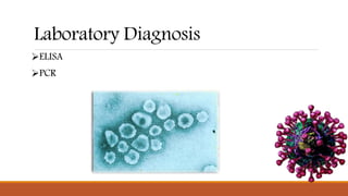 Laboratory Diagnosis
ELISA
PCR
 