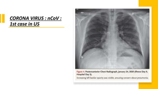 CORONA VIRUS : nCoV :
1st case in US
 