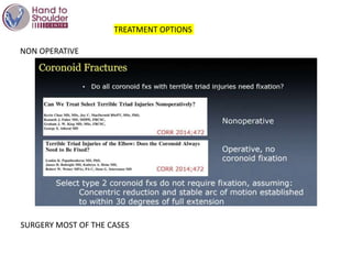 TREATMENT OPTIONS
NON OPERATIVE
SURGERY MOST OF THE CASES
 
