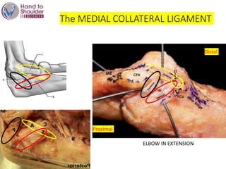 The MEDIAL COLLATERAL LIGAMENT
Proximal
Distal
ELBOW IN EXTENSION
 