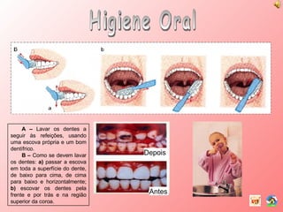 Higiene Oral A –  Lavar os dentes a seguir às refeições, usando uma escova própria e um bom dentífrico. B –  Como se devem lavar os dentes:  a)  passar a escova em toda a superfície do dente, de baixo para cima, de cima para baixo e horizontalmente;  b)  escovar os dentes pela frente e por trás e na região superior da coroa. Depois Antes 