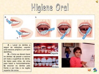 Higiene Oral A –  Lavar os dentes a seguir às refeições, usando uma escova própria e um bom dentífrico. B –  Como se devem lavar os dentes:  a)  passar a escova em toda a superfície do dente, de baixo para cima, de cima para baixo e horizontalmente;  b)  escovar os dentes pela frente e por trás e na região superior da coroa. Depois Antes 