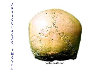 A
R
T
I
C
U
L
A
Ç
Ã
O
I
M
Ó
V
E
L
 