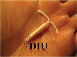 DIU

 