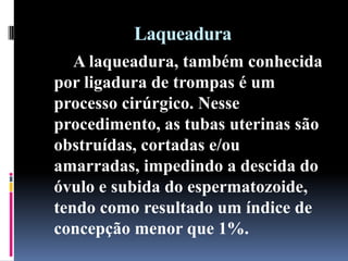 Laqueadura
A laqueadura, também conhecida
por ligadura de trompas é um
processo cirúrgico. Nesse
procedimento, as tubas uterinas são
obstruídas, cortadas e/ou
amarradas, impedindo a descida do
óvulo e subida do espermatozoide,
tendo como resultado um índice de
concepção menor que 1%.

 