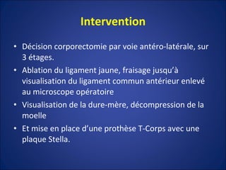 Intervention Décision corporectomie par voie antéro-latérale, sur 3 étages. Ablation du ligament jaune, fraisage jusqu’à visualisation du ligament commun antérieur enlevé au microscope opératoire Visualisation de la dure-mère, décompression de la moelle Et mise en place d’une prothèse T-Corps avec une plaque Stella. 