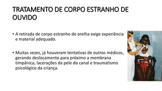 TRATAMENTO DE CORPO ESTRANHO DE
OUVIDO
• A retirada de corpo estranho de orelha exige experiência
e material adequado.
• Muitas vezes, já houveram tentativas de outros médicos,
gerando deslocamento para próximo a membrana
timpânica, lacerações da pele do canal e traumatismo
psicológico da criança.
 