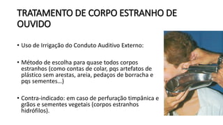 TRATAMENTO DE CORPO ESTRANHO DE
OUVIDO
• Uso de Irrigação do Conduto Auditivo Externo:
• Método de escolha para quase todos corpos
estranhos (como contas de colar, pqs artefatos de
plástico sem arestas, areia, pedaços de borracha e
pqs sementes…)
• Contra-indicado: em caso de perfuração timpânica e
grãos e sementes vegetais (corpos estranhos
hidrófilos).
 