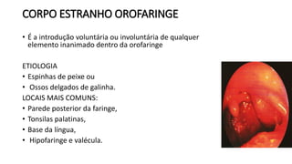 CORPO ESTRANHO OROFARINGE
• É a introdução voluntária ou involuntária de qualquer
elemento inanimado dentro da orofaringe
ETIOLOGIA
• Espinhas de peixe ou
• Ossos delgados de galinha.
LOCAIS MAIS COMUNS:
• Parede posterior da faringe,
• Tonsilas palatinas,
• Base da língua,
• Hipofaringe e valécula.
 