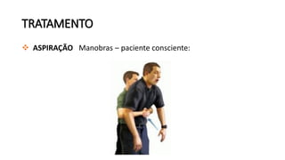  ASPIRAÇÃO Manobras – paciente consciente:
TRATAMENTO
 