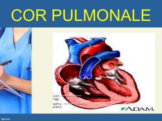 COR PULMONALE
 