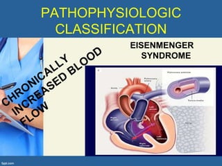 PATHOPHYSIOLOGIC
  CLASSIFICATION
          EISENMENGER
             SYNDROME
 