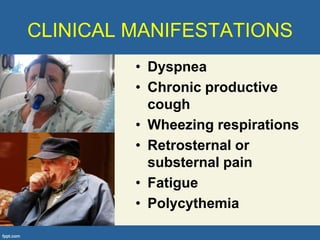 CLINICAL MANIFESTATIONS
         • Dyspnea
         • Chronic productive
           cough
         • Wheezing respirations
         • Retrosternal or
           substernal pain
         • Fatigue
         • Polycythemia
 