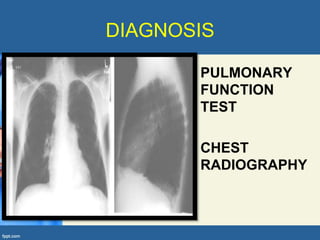 DIAGNOSIS

      • PULMONARY
        FUNCTION
        TEST

      • CHEST
        RADIOGRAPHY
 