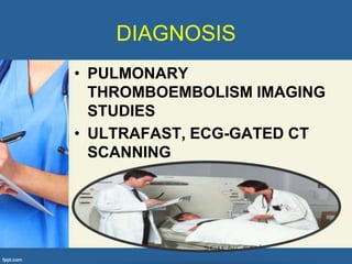 DIAGNOSIS
• PULMONARY
  THROMBOEMBOLISM IMAGING
  STUDIES
• ULTRAFAST, ECG-GATED CT
  SCANNING
 