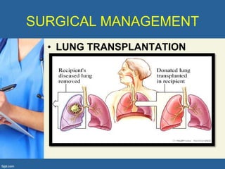 SURGICAL MANAGEMENT
  • LUNG TRANSPLANTATION
 