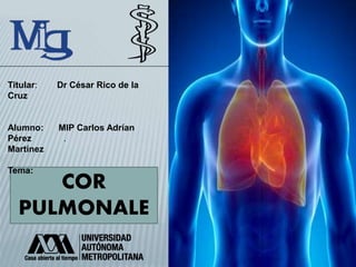 COR
PULMONALE
Titular: Dr César Rico de la
Cruz
Alumno: MIP Carlos Adrían
Pérez .
Martínez
Tema:
 