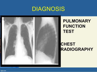 DIAGNOSIS
PULMONARY
FUNCTION
TEST
CHEST
RADIOGRAPHY
 