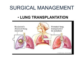 SURGICAL MANAGEMENT
• LUNG TRANSPLANTATION
 
