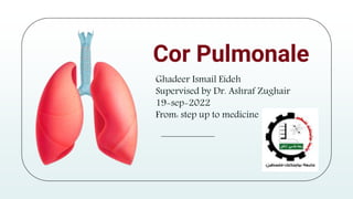 Cor Pulmonale
Ghadeer Ismail Eideh
Supervised by Dr. Ashraf Zughair
19-sep-2022
From: step up to medicine
 