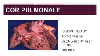 COR PULMONALE
SUBMITTED BY
Anmol Prashar
Bsc.Nursing 4th year
(Intern)
Roll no 6
 