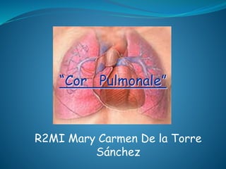 “Cor Pulmonale”
R2MI Mary Carmen De la Torre
Sánchez
 