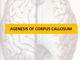 AGENESIS OF CORPUS CALLOSUM
 
