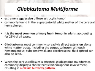 Glioblastoma Multiforme
• extremely aggressive diffuse astrocytic tumor
• commonly found in the supratentorial white matter of the cerebral
hemispheres.
• It is the most common primary brain tumor in adults, accounting
for 25% of all cases.
• Glioblastomas most commonly spread via direct extension along
white matter tracts, including the corpus callosum, although
hematogenous, subependymal, and cerebrospinal fluid spread can
also be seen.
• When the corpus callosum is affected, glioblastoma multiformes
commonly display a characteristic bihemispheric involvement,
resulting in a classic butterfly pattern.
 