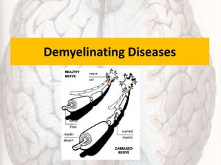 Demyelinating Diseases
 