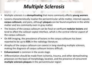 Multiple Sclerosis
• Multiple sclerosis is a demyelinating that more commonly affects young women.
• Lesions characteristically involve the periventricular white matter, internal capsule,
corpus callosum, and pons, although plaques can be found anywhere in the white
matter and less commonly even in gray matter.
• The lesions of the corpus callosum can be focal or confluent nodular lesions and
tend to affect the callosal–septal interface, which is the central inferior aspect of
the corpus callosum.
• On MR imaging, the prevalence of lesions in the corpus callosum has been
reported to be up to 93% in the radiology literature.
• Atrophy of the corpus callosum can coexist in long-standing multiple sclerosis,
making the diagnosis of corpus callosum lesions difficult.
• Enhancement is common in the acute stage.
• Differentiation should be made from ischemia, trauma, and other demyelinating
processes on the basis of morphology, location, and the presence of concurrent
multiple sclerosis plaques in the periventricular region
 