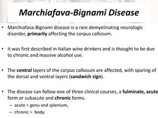 Marchiafava-Bignami Disease
• Marchiafava-Bignami disease is a rare demyelinating neurologic
disorder, primarily affecting the corpus callosum.
• It was first described in Italian wine drinkers and is thought to be due
to chronic and massive alcohol use.
• The central layers of the corpus callosum are affected, with sparing of
the dorsal and ventral layers (sandwich sign).
• The disease can follow one of three clinical courses, a fulminate, acute
form or subacute and chronic forms.
– acute = genu and splenium,
– chronic = body.
 