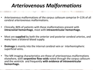 Arteriovenous Malformations
• Arteriovenous malformations of the corpus callosum comprise 9–11% of all
cerebral arteriovenous malformations.
• Clinically, 84% of patients with these malformations present with
intracranial hemorrhage, most with intraventricular hemorrhage.
• Most are supplied by both the anterior and posterior cerebral arteries, and
many have a bilateral blood supply.
• Drainage is mainly into the internal cerebral vein or interhemispheric
superficial veins.
• The MR imaging characteristics are those of arteriovenous malformations
elsewhere, with serpentine flow voids noted through the corpus callosum
and the ventricle and frequently with evidence of intraventricular
hemorrhage.
 