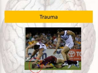 Trauma
 