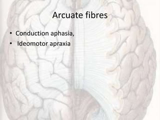 Arcuate fibres
• Conduction aphasia,
• Ideomotor apraxia
 