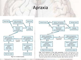 Apraxia
 