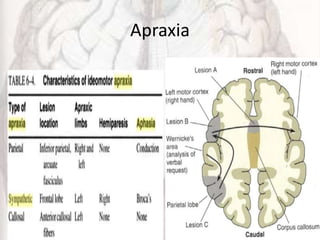 Apraxia
 