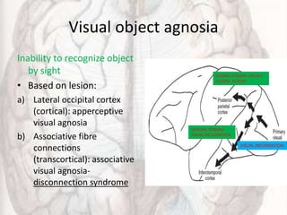 Visual object agnosia
Inability to recognize object
by sight
• Based on lesion:
a) Lateral occipital cortex
(cortical): apperceptive
visual agnosia
b) Associative fibre
connections
(transcortical): associative
visual agnosia-
disconnection syndrome
DORSAL STREAM-VISUALY
GUIDED ACTION
VISUAL INFORMATION
VENTRAL STREAM-
VISUAL RECOGNITION
 