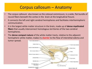 Corpus callosum – Anatomy
• The corpus callosum also known as the colossal commissure, is a wide, flat bundle of
neural fibers beneath the cortex in the brain at the longitudinal fissure.
• It connects the left and right cerebral hemispheres and facilitates interhemispheric
communication.
• It is the largest white matter structure in the brain, made up of dense myelinated
fibers that usually interconnect homologous territories of the two cerebral
hemispheres.
• The dense compact nature of the white matter tracts, relative to the adjacent
hemispheric white matter, makes it a barrier to the flow of interstitial edema and
tumor spread.
 