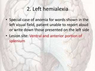 2. Left hemialexia
• Special case of anomia for words shown in the
left visual field, patient unable to report aloud
or write down those presented on the left side
• Lesion site: Ventral and anterior portion of
splenium
 
