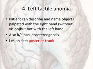 4. Left tactile anomia
• Patient can describe and name objects
palpated with the right hand (without
vision)but not with the left hand
• Also k/a pseudoastereognosis
• Lesion site: posterior trunk
 