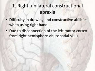 1. Right unilateral constructional
apraxia
• Difficulty in drawing and constructive abilities
when using right hand
• Due to disconnection of the left motor cortex
from right hemisphere visuospatial skills
 